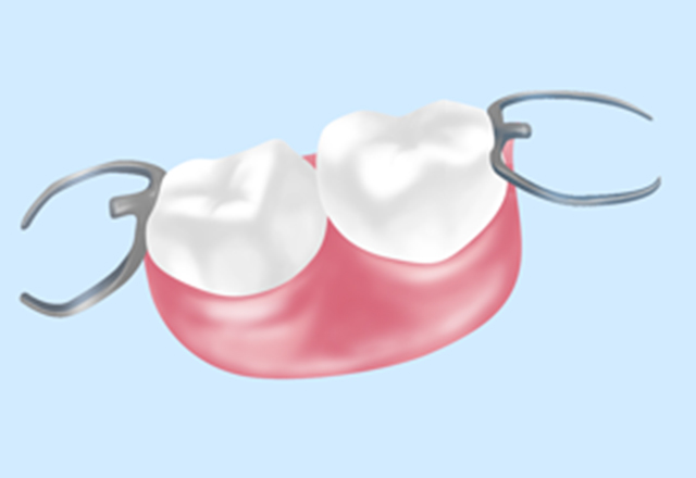 保険外の義歯（入れ歯）