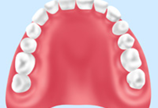保険の義歯（入れ歯）